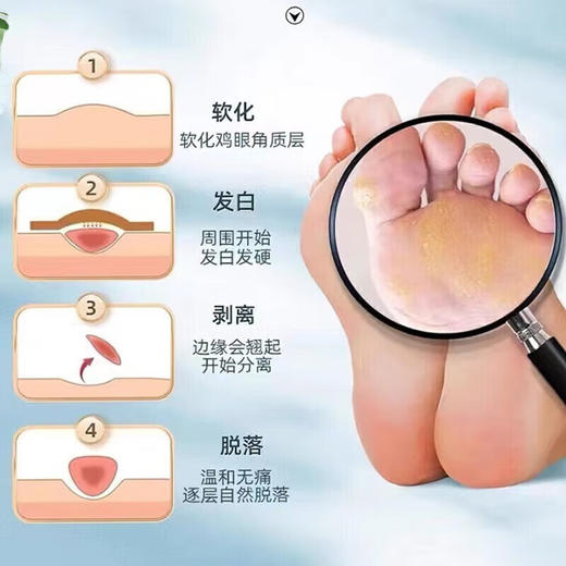 马应龙水杨酸软膏10g头癣足癣去角质增生去鸡皮正品尿素组合 商品图4