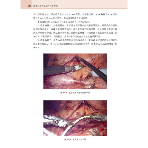 康多机器人泌尿外科手术学 李学松 崔亮 主编 全面介绍康多机器人辅助腹腔镜肾上腺 肾 肾盂 输尿管 前列腺 膀胱手术及远程手术 商品图4