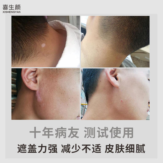 喜生颜白斑遮盖液防水外用持久脸部修饰肤色遮盖液30ml 商品图4