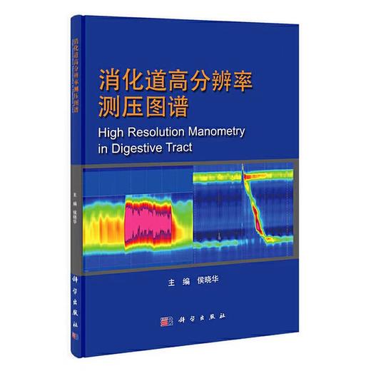消化道高分辨率测压图谱 商品图0