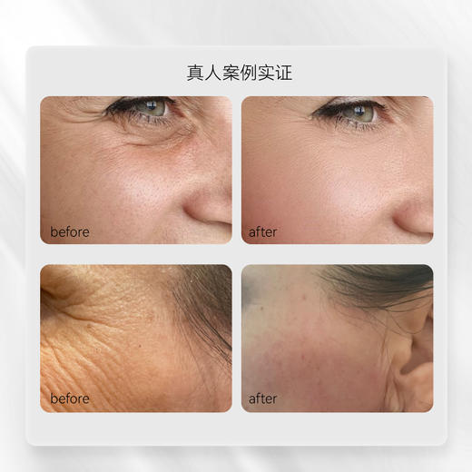 Dr.E.Voss德沃希 奢宠逆龄小金瓶精华30ml 紧致提拉丰盈 商品图3