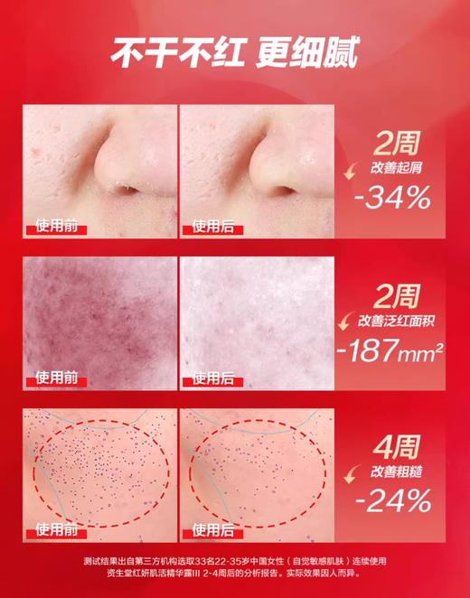 【航免仓】SHISEIDO资生堂红腰子红妍肌活精华露100ml 商品图2