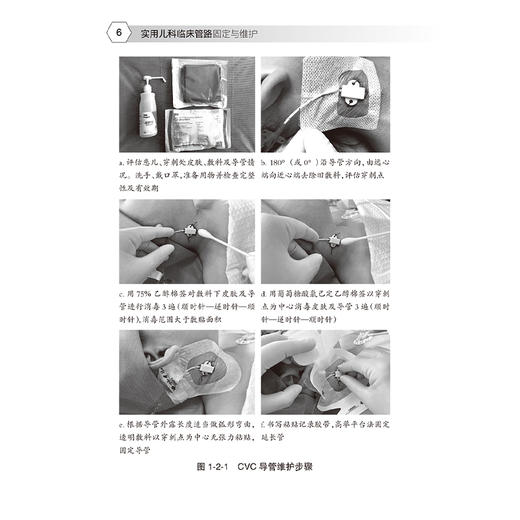 实用儿科临床管路固定与维护 王春立 内容涵盖动静脉留置管 各种引流管 喂养管 气管插管 透析管路等 9787117357531人民卫生出版社 商品图4