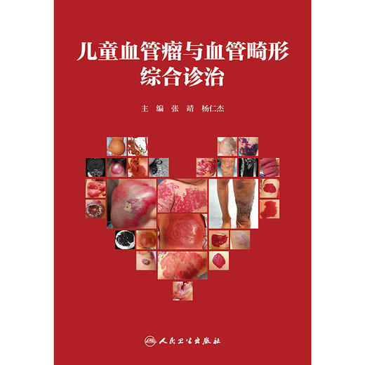 儿童血管瘤与血管畸形综合诊治 商品图1