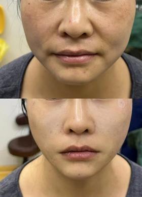 小10岁的老公，也被她熬成了“爹”？