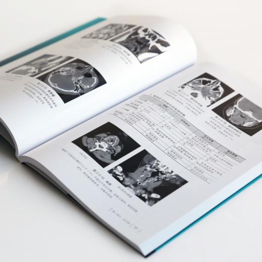 CT鉴别诊断一点通(第四版) 商品图4