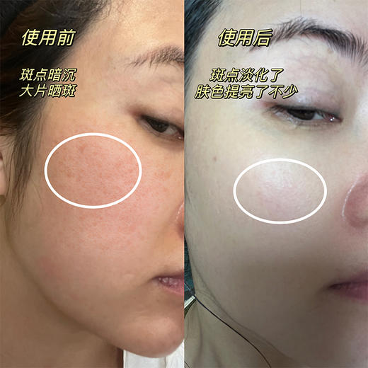 把垮下的脸拉回来！戴乐博士时空焕颜安瓶紧实提拉细腻淡细纹精华 商品图1