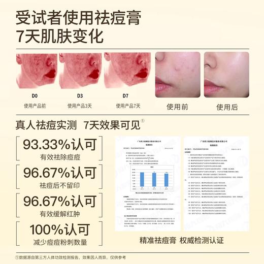 帕达诺12岁+精准祛痘霜20g 商品图2