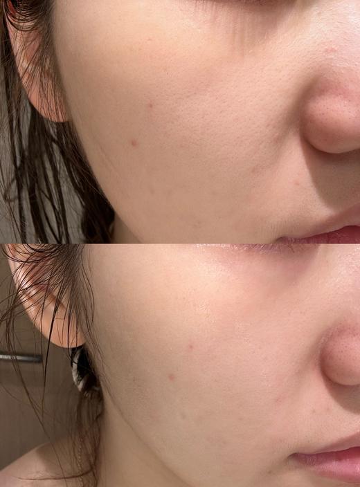 KATE女鬼面膜Kate Somervile凯诗薇胶原淡纹亮白焕活冻干周雨彤同款 商品图3