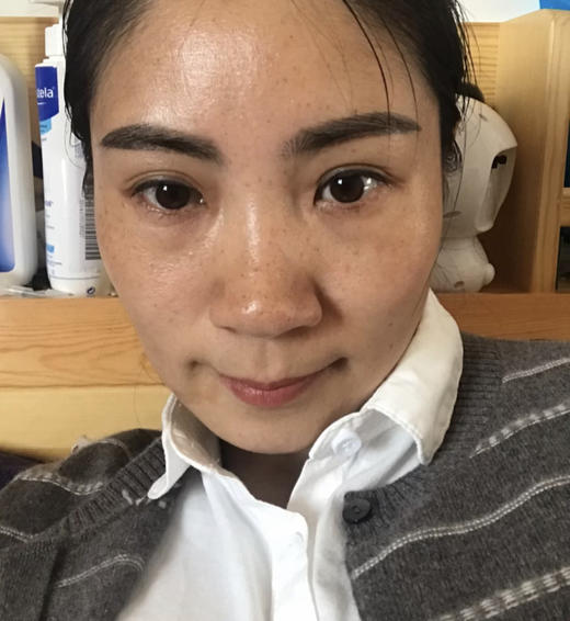 【2.19王炸割肉价】科颜氏淡斑精华50ml（限25年10月） 商品图2