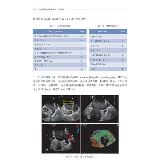 左心耳封堵术病例集 2024年 周达新主编 本书图文并茂 语言简练且配有丰富的检查和手术视频 临床医学 心脏病学上海科学技术出版社 商品图4