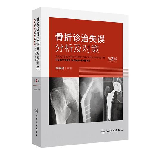 骨折诊治失误分析及对策 第2二版 张根民 病史采集中的失误 商品图0