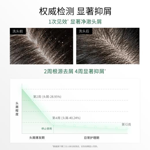 3odice三蒂丝 控油去屑洗发水油屑头适用【中欧专属】 商品图4
