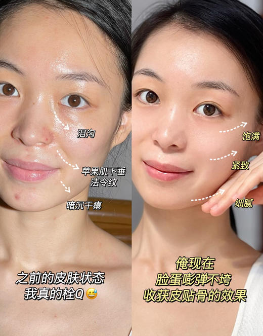 【4.26王炸割肉价】雅诗兰黛线雕精华15ml*2（无盒） 商品图5