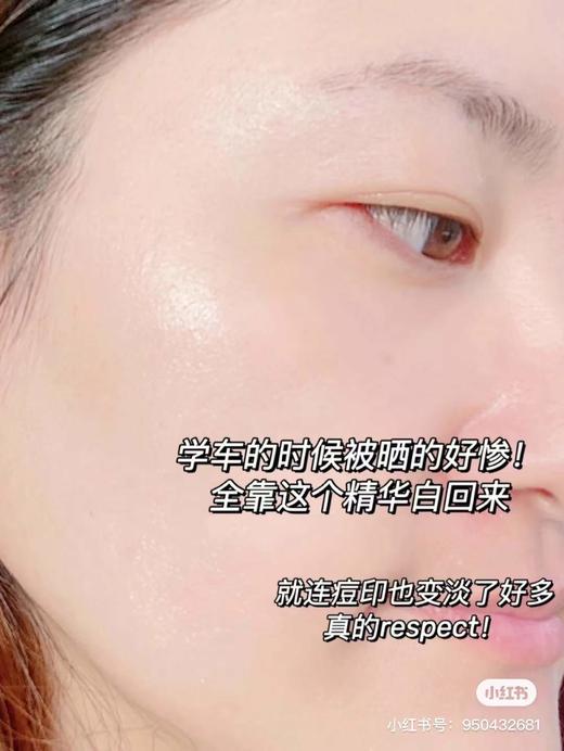 【2.19王炸割肉价】科颜氏淡斑精华50ml（限25年10月） 商品图5