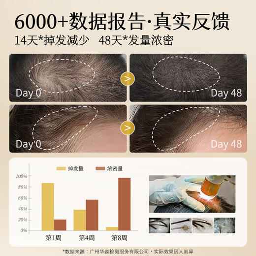 【新品上市】初夏堂十八宝去屑控油防脱洗发水 十八种中草药成分 植萃养护发根 固发防脱 商品图4