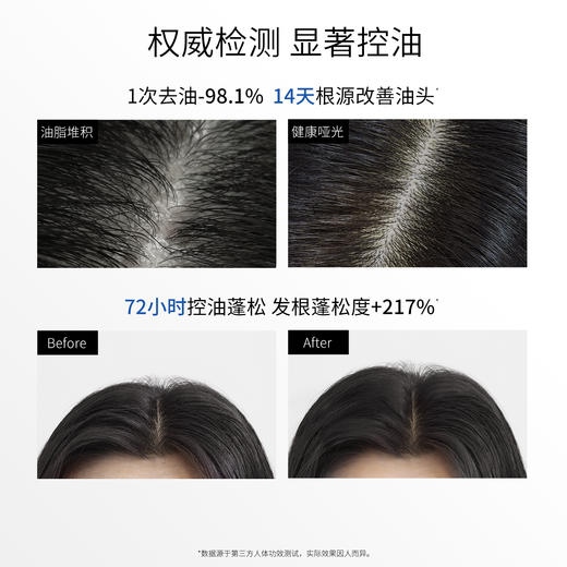 【油扁塌适用】3odice三蒂丝 控油蓬松洗发水 蓝盾洗发水 商品图3