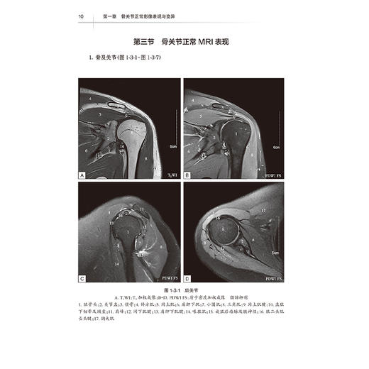 医学影像学读片诊断图谱 骨肌分册 第2二版 丁建平 龚向阳 主编 以骨肌系统常见疾病 多发病为主要介绍内容 人民卫生出版社 商品图4