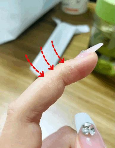 【泰国TH汗疱抑菌乳膏】湿疹皮炎的克星 泰国百年皇室传承配方，对汗疱疹、湿疹、皮炎、牛皮癣、荨麻疹..各种皮肤问题统统都有效!快速止痒“强效抑菌+修复屏障 商品图1