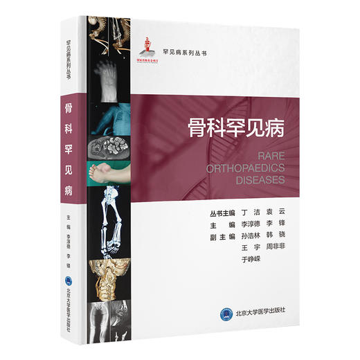 骨科罕见病   李淳德 李锋 主编   北医社 商品图0