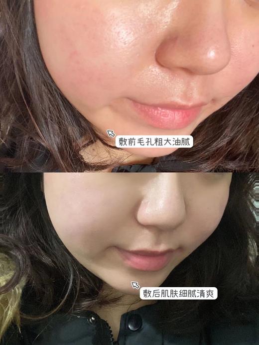 【清仓好价】美迪恩博士双萃碳酸面膜100g（效期至2025.5） 商品图3