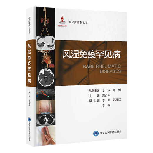 风湿免疫罕见病   栗占国 主编   北医社 商品图0
