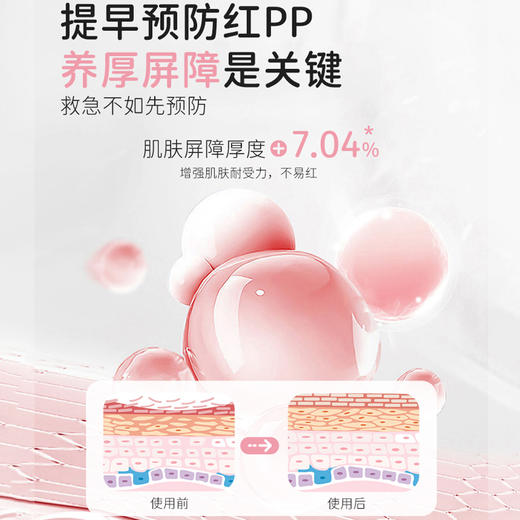 松达 特护 屁屁霜 50g 商品图3