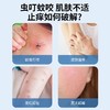 日本叮叮止痒膏液走珠滚珠宝宝婴幼儿专用蚊虫叮咬止 商品缩略图2