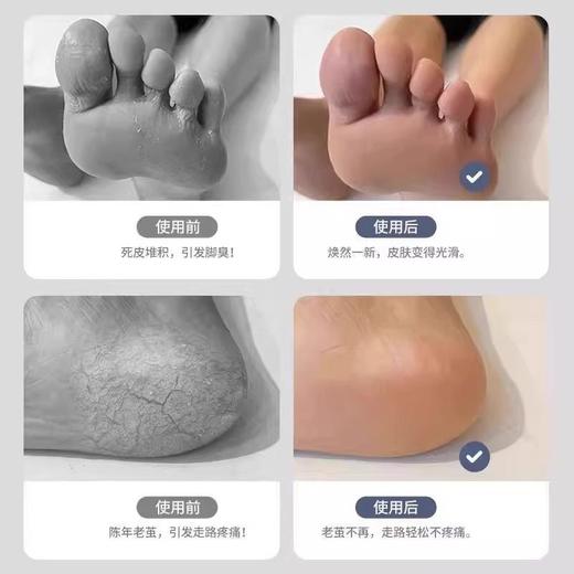 跟修脚双面刮不锈钢手动磨脚去死皮304搓脚家用神器老茧器后脚刀 商品图3