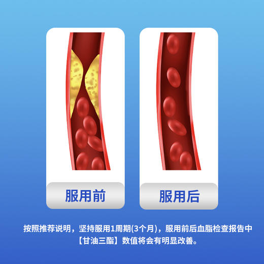 【畅瑞宁】纯南极磷虾油中老年成人 商品图3