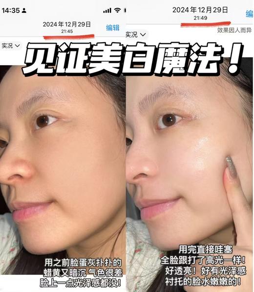 深圳税仓全新光子美白淡纹小灯泡 商品图9