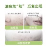 半价优惠，绽姸 控油祛痘平衡水乳 三件装 ，洁面泡沫100g +控油水120ml+控油乳50g（发新包装） 商品缩略图3