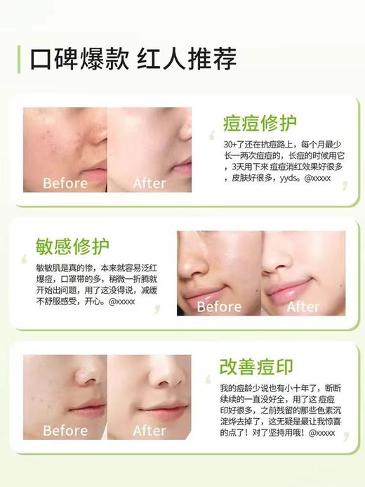 半价优惠，绽姸 控油祛痘平衡水乳 三件装 ，洁面泡沫100g +控油水120ml+控油乳50g（发新包装） 商品图4