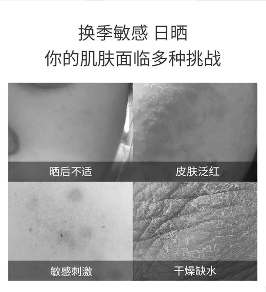 DR.DEEP干敏皮套装敏感肌肤护肤品天然植物舒缓泛红 商品图4