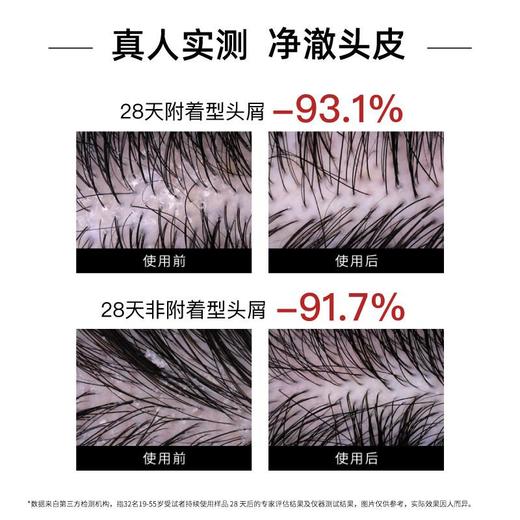 发玛21蓬松去屑洗发水600ml 商品图3