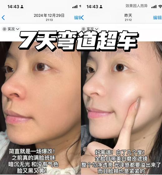 深圳税仓全新光子美白淡纹小灯泡 商品图7