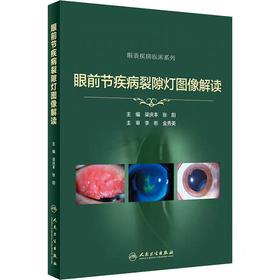 眼前节疾病裂隙灯图像解读