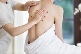  身上莫名其妙的出现血痣，那你一定要小心了！ 