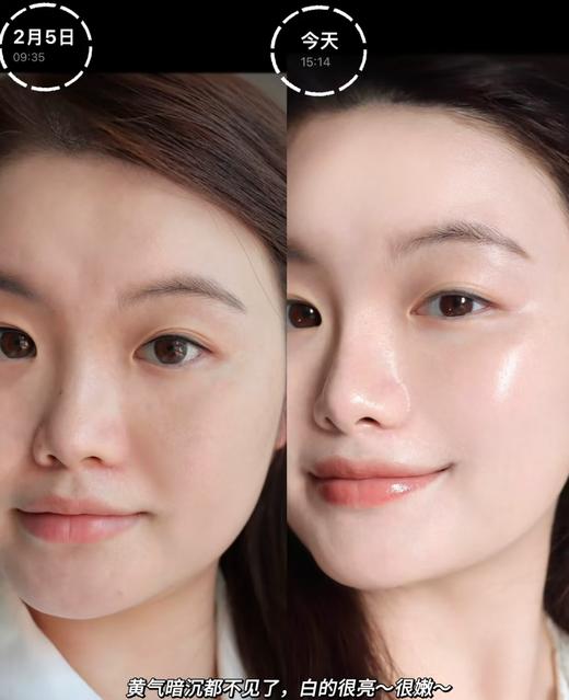 深圳税仓全新光子美白淡纹小灯泡 商品图4