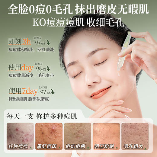 儒意复合酸焕颜次抛精华液30支/盒 水杨酸祛痘次抛精华液痘印痘坑修护淡化痘疤闭口粉刺黑头收缩毛孔|儒意官方商城 商品图1