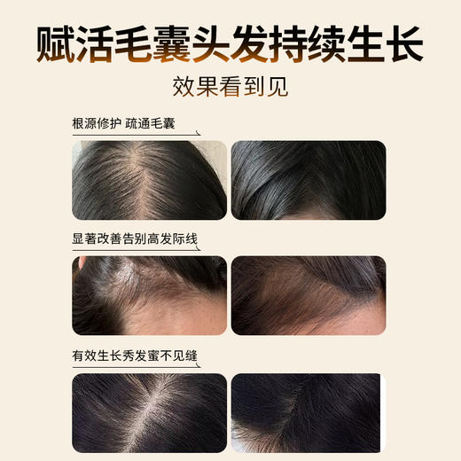 Skyoo美国进口生物素防脱护发【1357】 商品图7