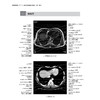 腹部影像解剖图谱 第2二版 周滟等 包括腹部断面影像解剖各脏器增强影像特点胆道影像解剖消化道 上海科学技术出版社9787547869246 商品缩略图3