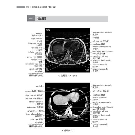腹部影像解剖图谱 第2二版 周滟等 包括腹部断面影像解剖各脏器增强影像特点胆道影像解剖消化道 上海科学技术出版社9787547869246 商品图3