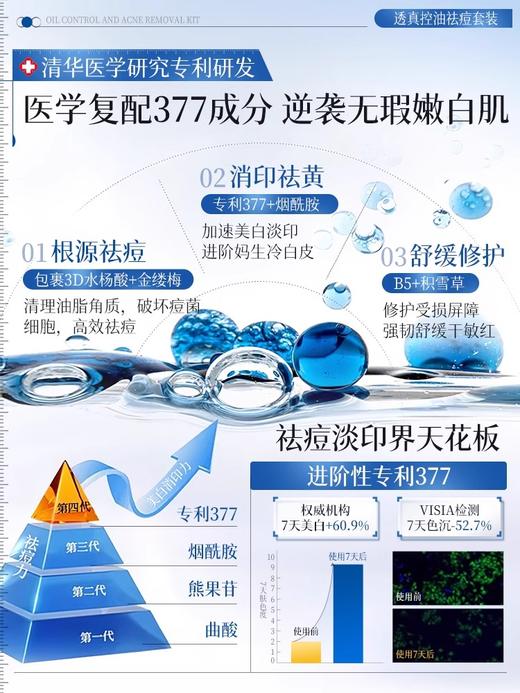 【美白祛痘 控油】#377美白祛痘水乳套装控油收缩毛孔补水保湿正品旗舰店女男护肤品 商品图3