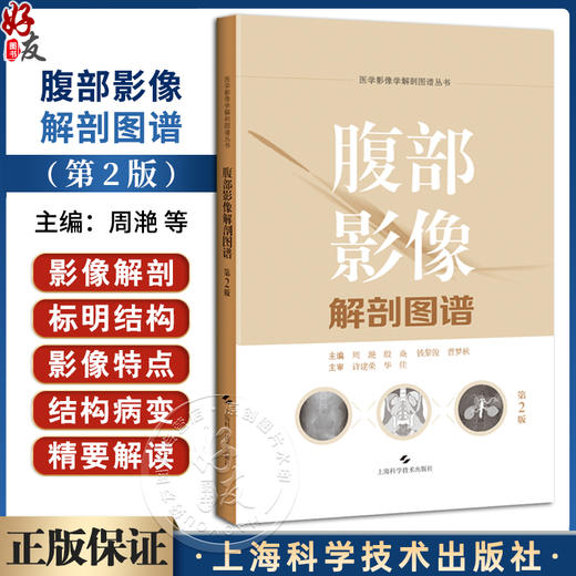 腹部影像解剖图谱 第2二版 周滟等 包括腹部断面影像解剖各脏器增强影像特点胆道影像解剖消化道 上海科学技术出版社9787547869246 商品图0