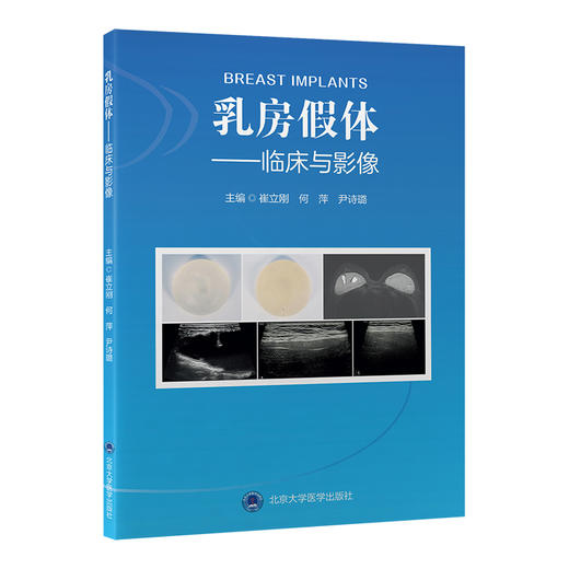 乳房假体——临床与影像    崔立刚 何萍 尹诗璐 主编   北医社 商品图0