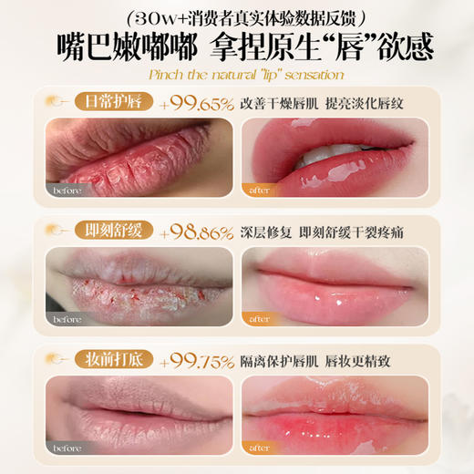 唇部精华油润唇膏补水保湿滋润淡化唇纹去死皮防干裂护理男女|儒意官方商城 商品图3