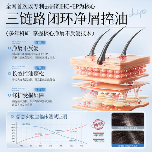 儒意控油去屑止痒洗发水500g 去屑止痒除螨控油蓬松洗头膏露夏天男女|儒意官方商城 商品图2