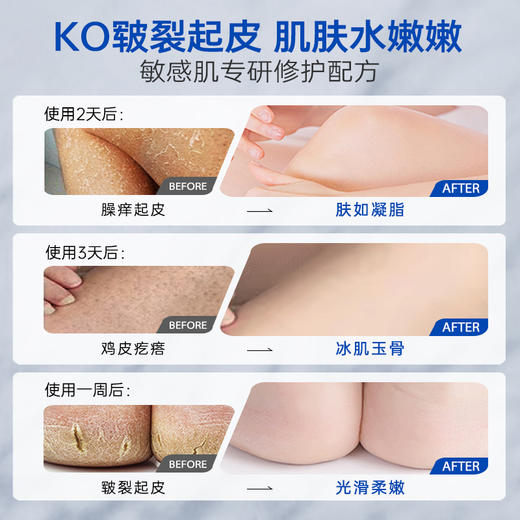 【🔥99选3件】送双12礼包5️⃣件件 维生素e身体乳液保湿补水滋润修护正品官方旗舰店维E女男通用|儒意官方旗舰店 商品图6