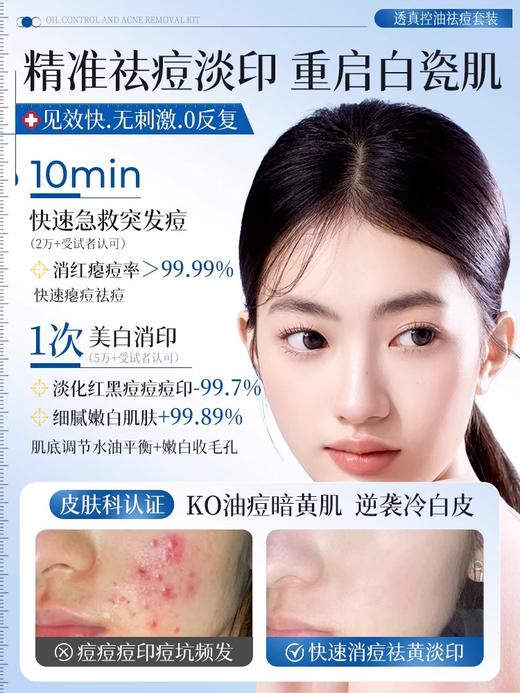 【美白祛痘 控油】#377美白祛痘水乳套装控油收缩毛孔补水保湿正品旗舰店女男护肤品 商品图1